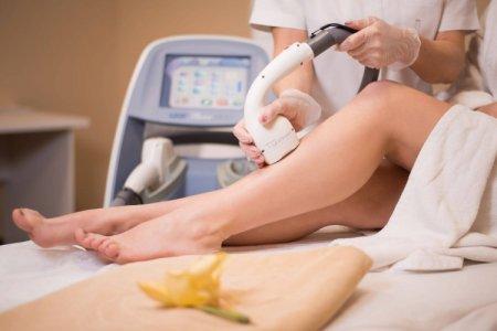 Laser hair removal: everything about the procedure, how it is done and how to prepare